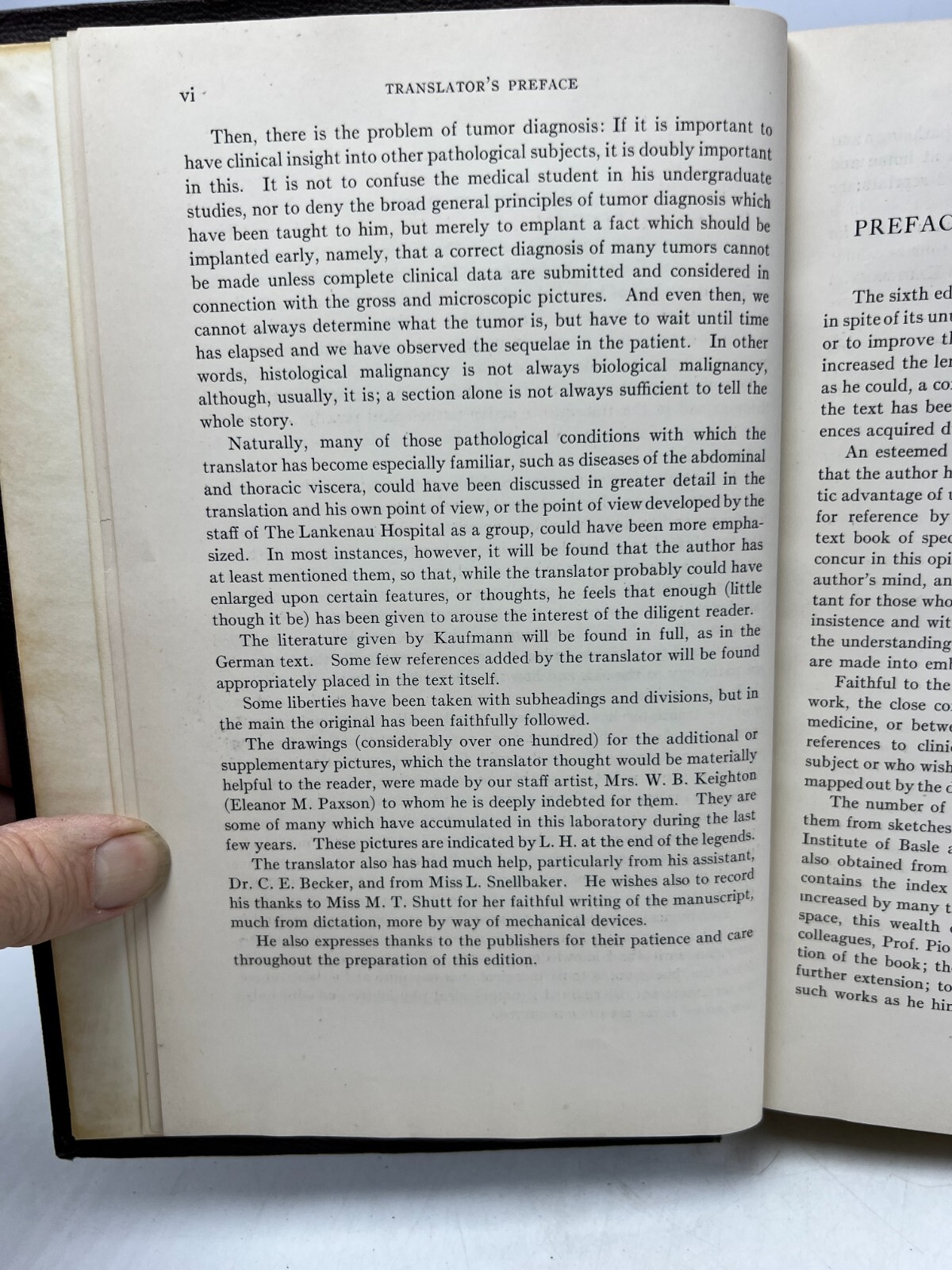 Pathology for Students and Practitioner&rsquo;s Volumes I, II, III by Kaufmann (1929,H
